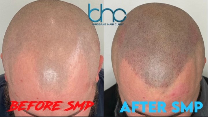Before & After